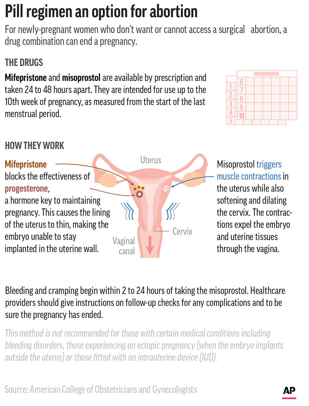Medication abortion explained